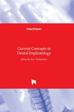 Current Concepts in Dental Implantology