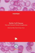 Sickle Cell Disease