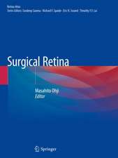 Surgical Retina