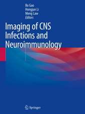 Imaging of CNS Infections and Neuroimmunology