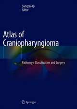 Atlas of Craniopharyngioma: Pathology, Classification and Surgery