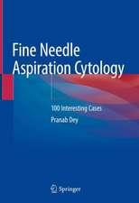 Fine Needle Aspiration Cytology: 100 Interesting Cases