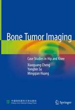 Bone Tumor Imaging: Case Studies in Hip and Knee