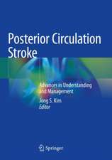 Posterior Circulation Stroke: Advances in Understanding and Management