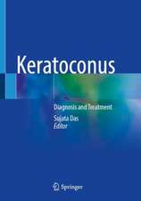 Keratoconus: Diagnosis and Treatment