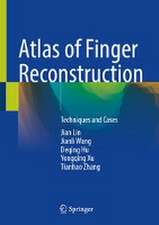 Atlas of Finger Reconstruction: Techniques and Cases