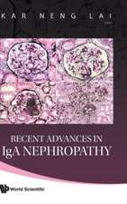 Recent Advances in IGA Nephropathy: A Finite/Infinite Element Approach