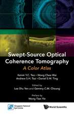 Swept-Source Optical Coherence Tomography