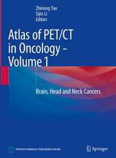 Atlas of PET/CT in Oncology - Volume 1: Brain, Head and Neck Cancers