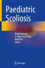 Paediatric Scoliosis