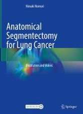 Anatomical Segmentectomy for Lung Cancer: Illustration and Videos