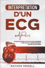 Interprétation d'un ECG