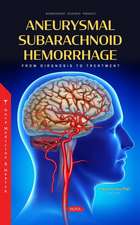 Aneurysmal Subarachnoid Hemorrhage: From Diagnosis to Treatment