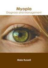 Myopia: Diagnosis and Management