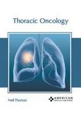 Thoracic Oncology